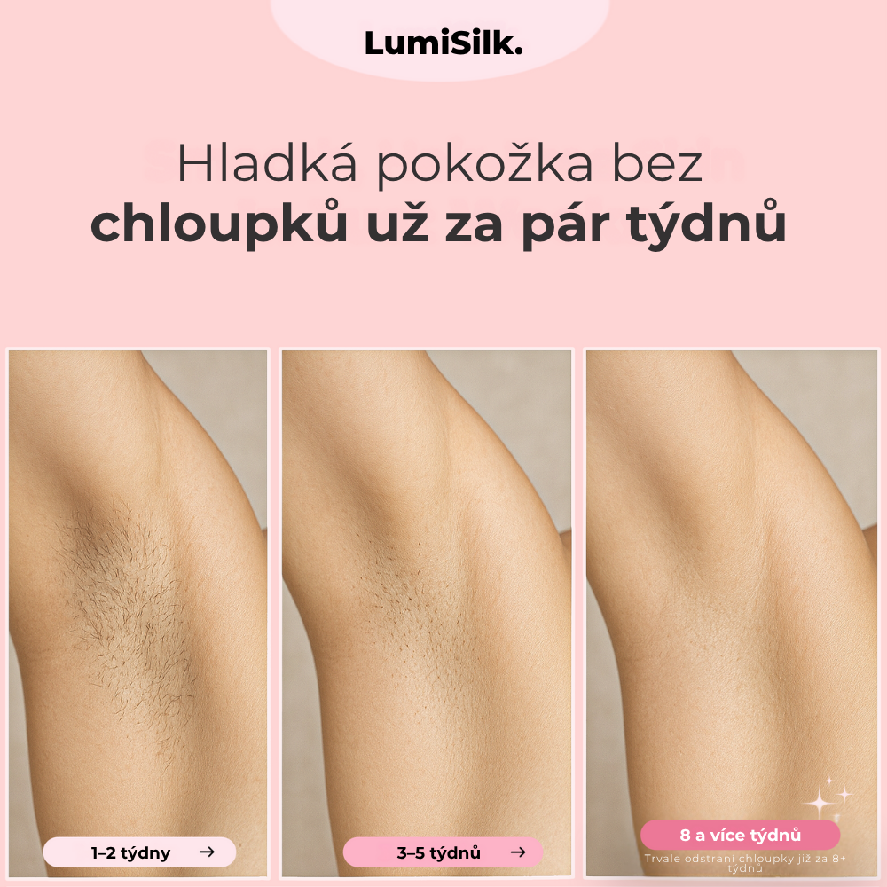 Výsledky před a po použití Lumina – hladká pokožka bez chloupků za pouhých 8 týdnů díky technologii IPL.