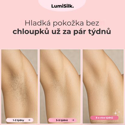 Výsledky před a po použití Lumina – hladká pokožka bez chloupků za pouhých 8 týdnů díky technologii IPL.