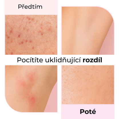 Před a po použití oleje po holení Silky Balloon od LumiSilk – zklidňuje podráždění, zarudnutí a pupínky po holení, viditelný rozdíl na pokožce